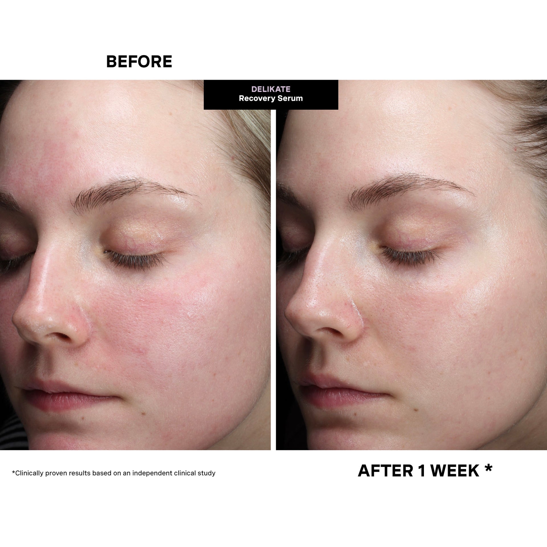 DeliKate® Recovery Serum