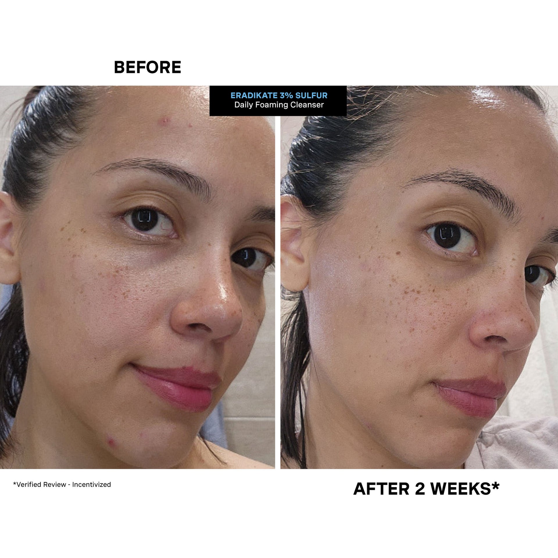 EradiKate™ Daily Foaming Cleanser