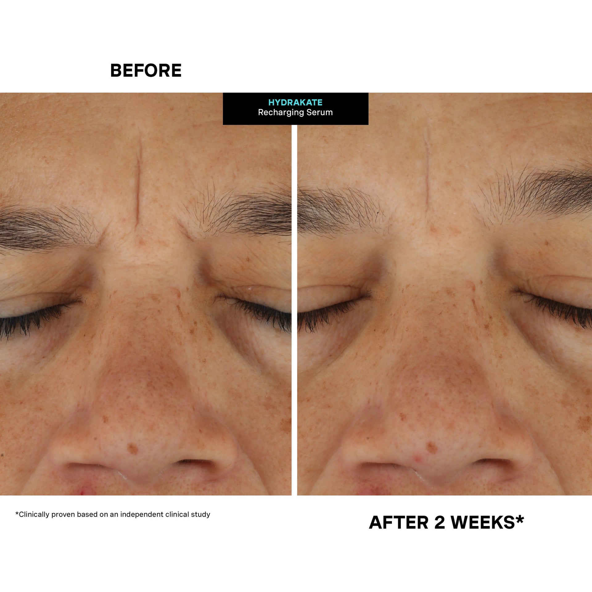 HydraKate™ Recharging Serum