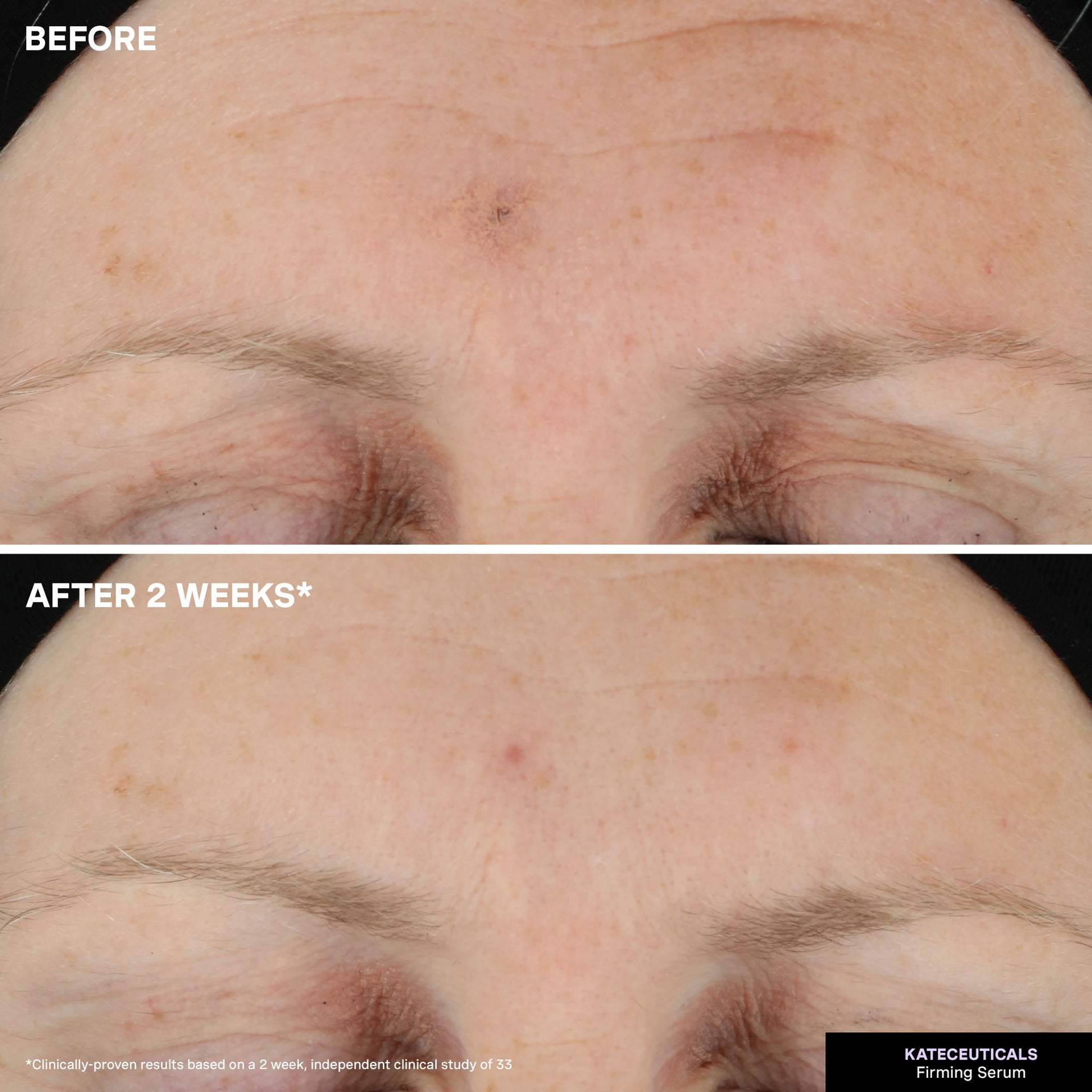 KateCeuticals™ Firming Serum