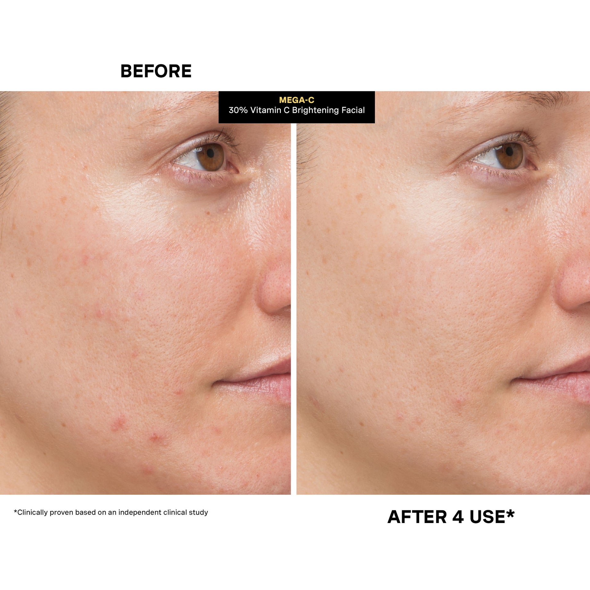 MEGA-C™ 30% Vitamin C Brightening Facial