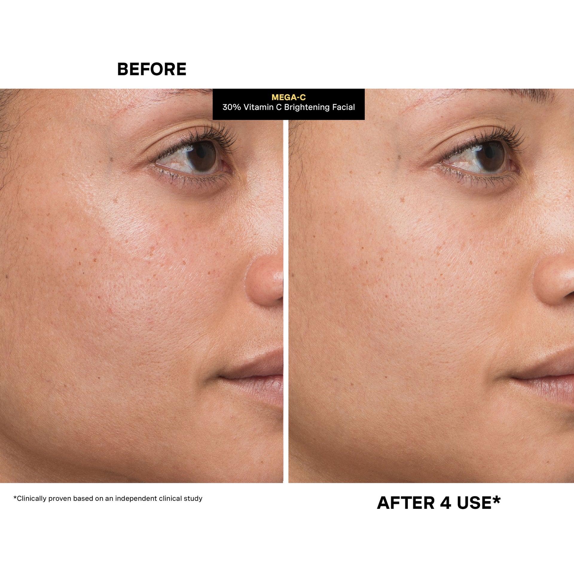 MEGA-C™ 30% Vitamin C Brightening Facial