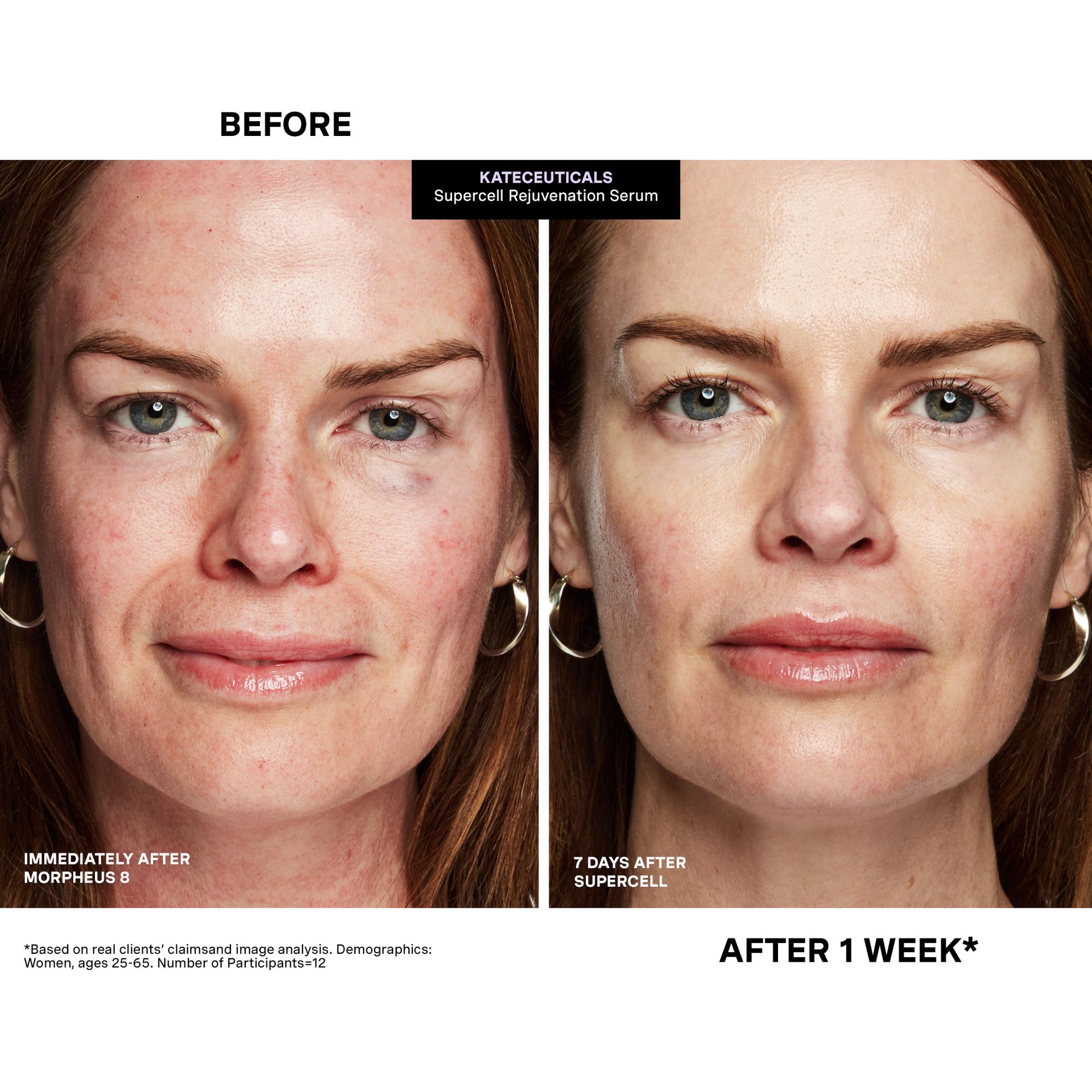 KateCeuticals SuperCell Rejuvenation Serum