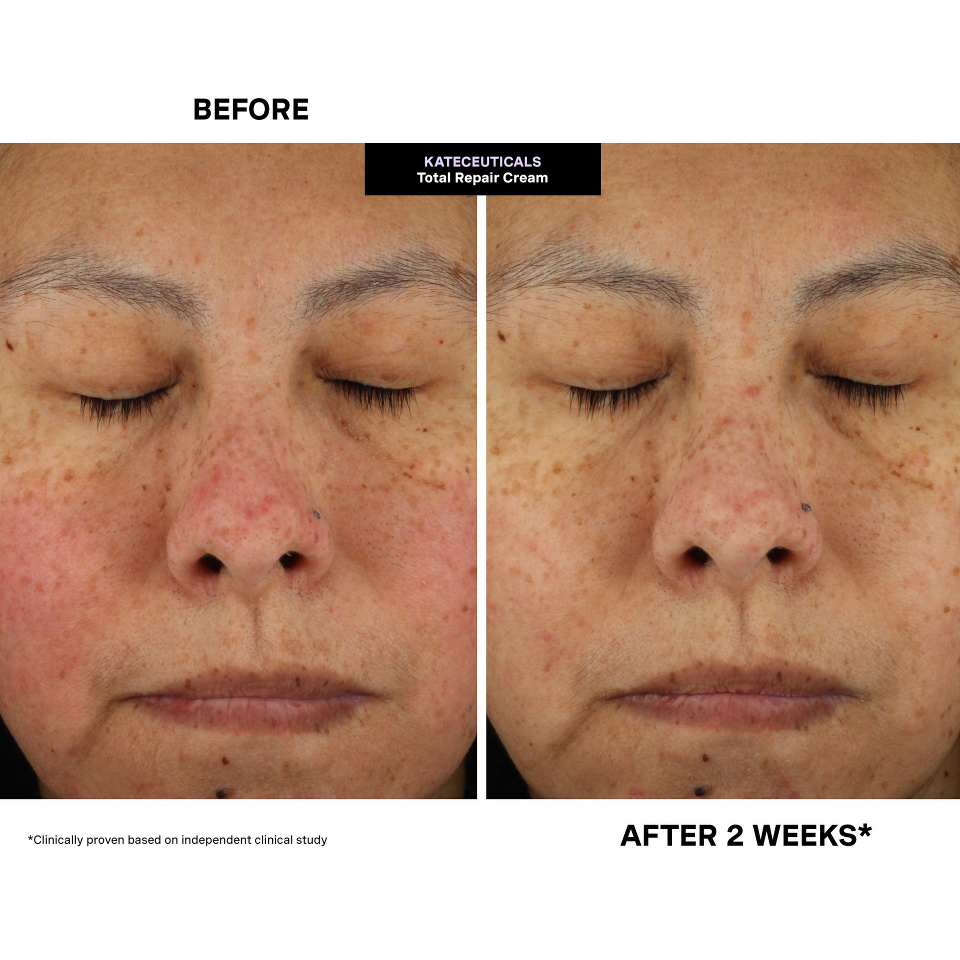 Kateceuticals™ Total Repair Cream