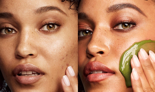 HOW TO REVIVE DULL SKIN