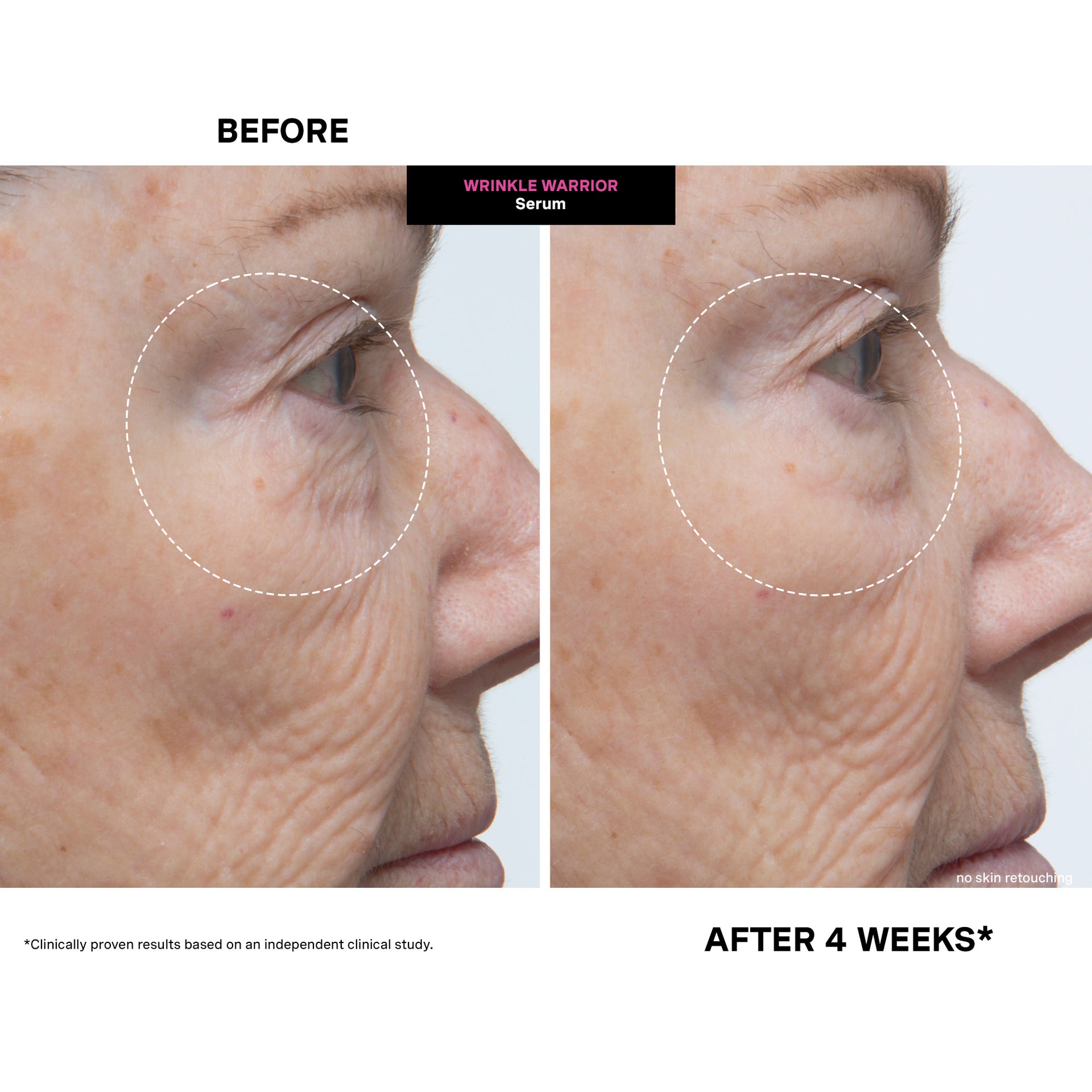 Wrinkle Warrior® 2-in-1 Plumping Serum + Moisturiser