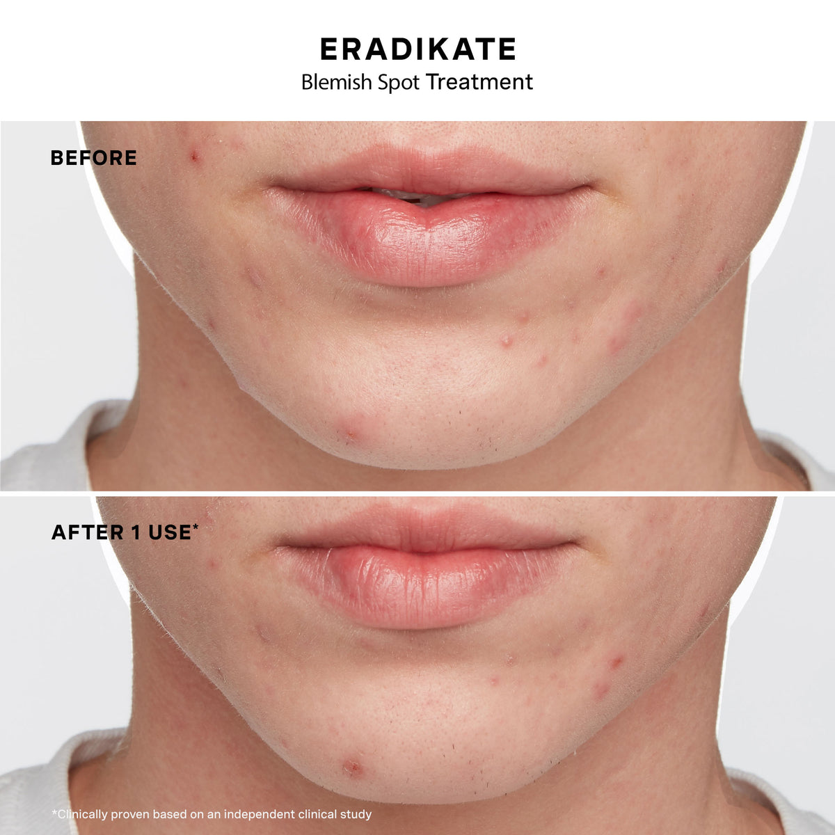 Before and after results