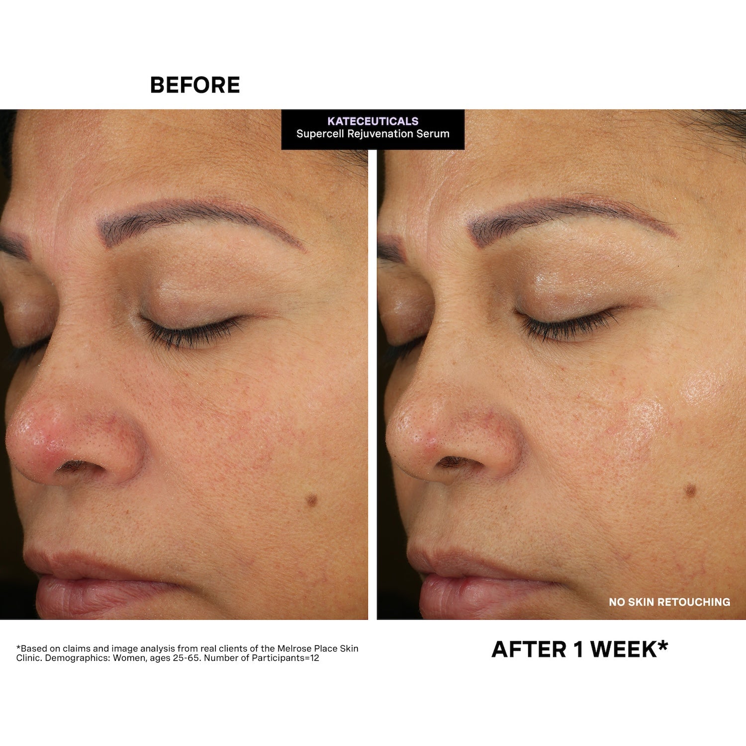 KateCeuticals SuperCell Rejuvenation Serum