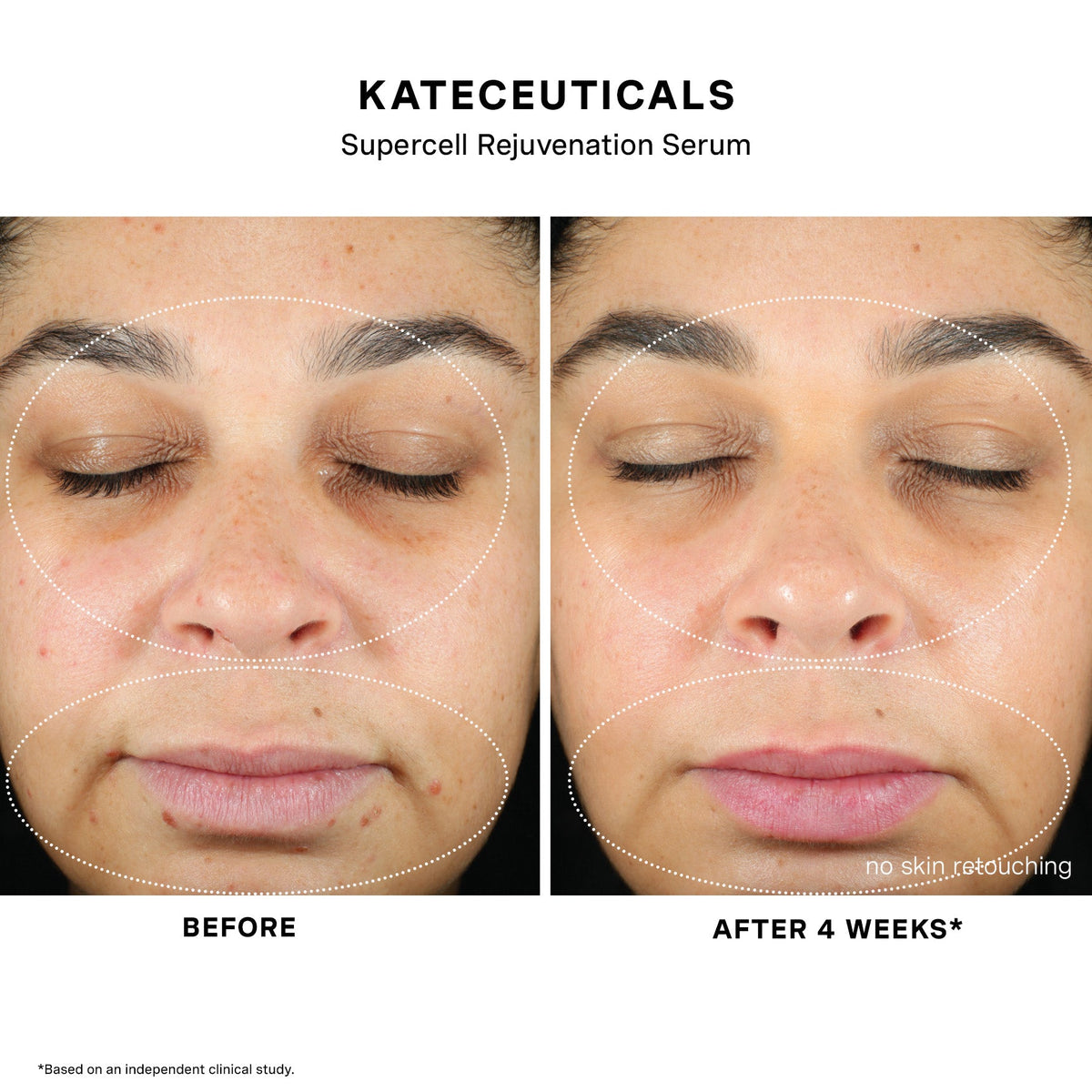Before and after results 1